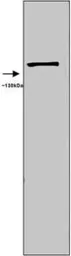Anti-iNOS antibody used in Western Blot (WB). GTX74171