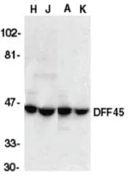 Anti-ICAD antibody used in Western Blot (WB). GTX74223