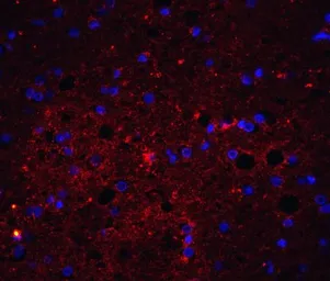 Anti-TRAIL antibody used in IHC (Paraffin sections) (IHC-P). GTX74230