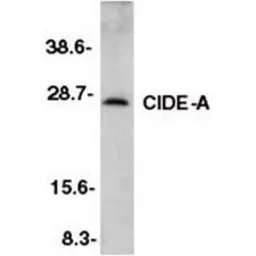 Anti-CIDE A antibody used in Western Blot (WB). GTX74347