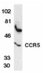 Anti-CCR5 antibody used in Western Blot (WB). GTX74371