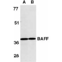 Anti-BAFF antibody used in Western Blot (WB). GTX74388