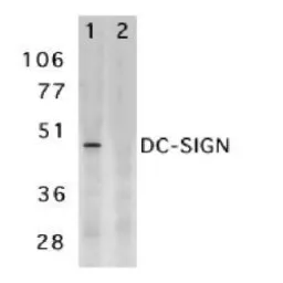 Anti-DC-SIGN antibody used in Western Blot (WB). GTX74430