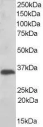 Anti-TXNDC1 antibody, C-term used in Western Blot (WB). GTX74441