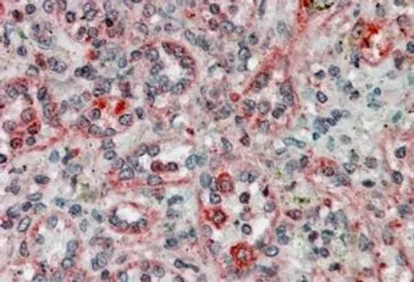 Anti-TXNDC1 antibody, C-term used in IHC (Paraffin sections) (IHC-P). GTX74441