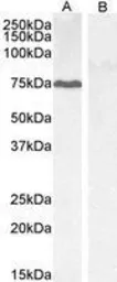 Anti-GADD34 antibody, C-term used in Western Blot (WB). GTX74479