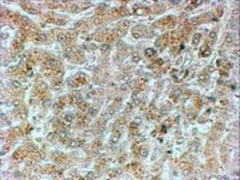 Anti-GADD34 antibody, C-term used in IHC (Paraffin sections) (IHC-P). GTX74479