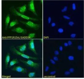 Anti-GADD34 antibody, C-term used in Immunocytochemistry/ Immunofluorescence (ICC/IF). GTX74479