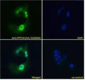 Anti-GADD34 antibody, C-term used in Immunocytochemistry/ Immunofluorescence (ICC/IF). GTX74479