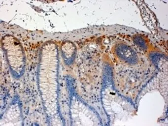 Anti-CSK antibody used in IHC (Paraffin sections) (IHC-P). GTX74502