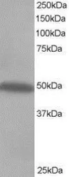 Anti-CSK antibody used in Western Blot (WB). GTX74502