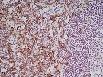 Anti-CD8 alpha antibody [YTS105.18] used in IHC (Frozen sections) (IHC-Fr). GTX74642