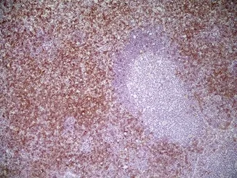 Anti-CD8 alpha antibody [YTS105.18] used in IHC (Frozen sections) (IHC-Fr). GTX74642