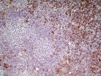 Anti-CD8 alpha antibody [YTS105.18] used in IHC (Frozen sections) (IHC-Fr). GTX74642