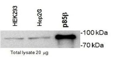 Anti-PI3 kinase p85 beta antibody [T15] used in Western Blot (WB). GTX74710