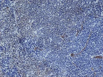 Anti-CD31 antibody [TLD-3A12] used in IHC (Frozen sections) (IHC-Fr). GTX74899