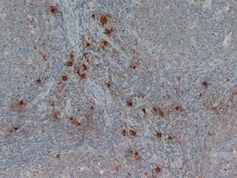 Anti-Mast cell tryptase antibody [AA1] used in IHC (Paraffin sections) (IHC-P). GTX75011