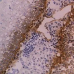 Anti-Integrin beta 4 antibody [450-9D] used in IHC (Frozen sections) (IHC-Fr). GTX75041
