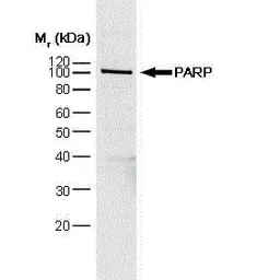 Anti-PARP antibody [A6.4.12] used in Western Blot (WB). GTX75098