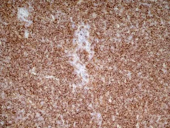 Anti-CD4 antibody [OX-35] used in IHC (Frozen sections) (IHC-Fr). GTX75109