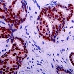 Anti-p53 antibody [DO-7] used in IHC (Paraffin sections) (IHC-P). GTX75255