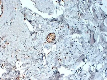 Anti-Estrogen Receptor alpha antibody [6F11] used in IHC (Paraffin sections) (IHC-P). GTX75362