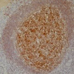 Anti-CD21 antibody [2G9] used in IHC (Paraffin sections) (IHC-P). GTX75378
