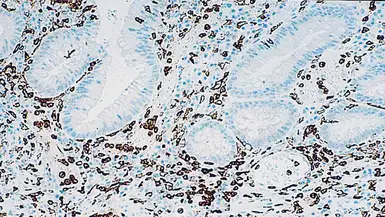 Anti-CD16 antibody [2H7] used in IHC (Paraffin sections) (IHC-P). GTX75391