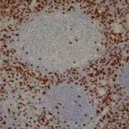 Anti-CD8 antibody [4B11] used in IHC (Paraffin sections) (IHC-P). GTX75393
