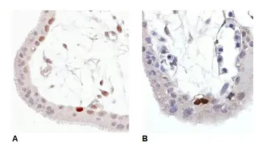 Anti-p53 (phospho Ser392) antibody [FP3.2(FPS392)] used in IHC (Paraffin sections) (IHC-P). GTX75422