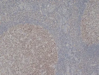 Anti-MCM2 antibody [CRCT2.1 (D1.9H5)] used in IHC (Paraffin sections) (IHC-P). GTX75459