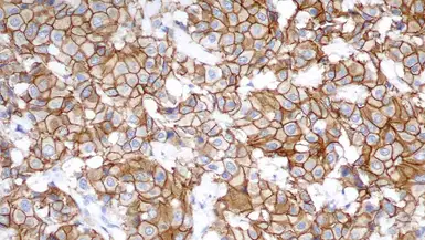 Anti-Her2 / ErbB2 antibody [CB11] used in IHC (Paraffin sections) (IHC-P). GTX75559