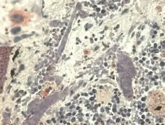 Anti-HLA-G antibody [MEM-G/1] used in  (). GTX75708