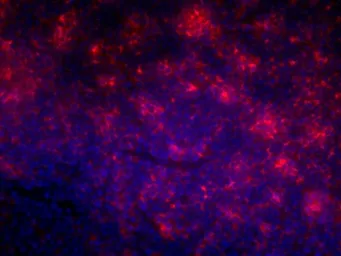 Anti-CD4 (Domain 1) antibody [OX-38] used in IHC (Frozen sections) (IHC-Fr). GTX76103