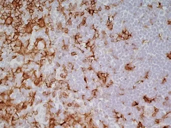 Anti-CD4 (Domain 1) antibody [OX-38] used in IHC (Frozen sections) (IHC-Fr). GTX76103