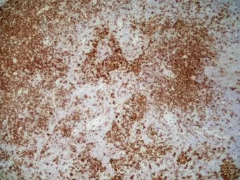 Anti-CD4 (Domain 1) antibody [OX-38] used in IHC (Frozen sections) (IHC-Fr). GTX76103
