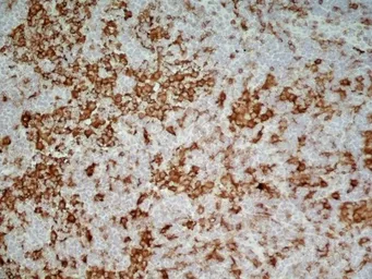 Anti-CD4 (Domain 1) antibody [OX-38] used in IHC (Frozen sections) (IHC-Fr). GTX76103