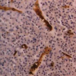 Anti-Glycophorin A antibody [YTH89.1] used in IHC (Paraffin sections) (IHC-P). GTX76244