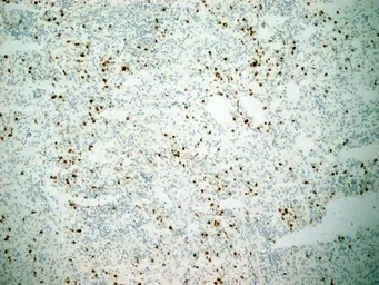 Anti-CD11b antibody [ICRF44] (Azide free) used in IHC (Frozen sections) (IHC-Fr). GTX76296