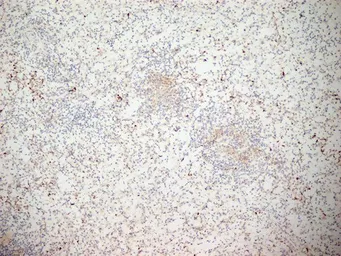 Anti-CD11b antibody [ICRF44] (Azide free) used in IHC (Frozen sections) (IHC-Fr). GTX76296