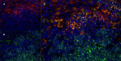 Anti-CD4 antibody [W3/25] used in IHC (Frozen sections) (IHC-Fr). GTX76318
