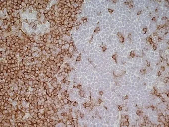 Anti-CD4 antibody [W3/25] used in IHC (Frozen sections) (IHC-Fr). GTX76318