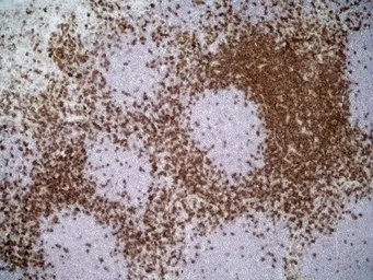Anti-CD4 antibody [W3/25] used in IHC (Frozen sections) (IHC-Fr). GTX76318