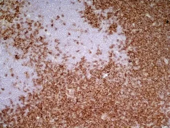 Anti-CD4 antibody [W3/25] used in IHC (Frozen sections) (IHC-Fr). GTX76318