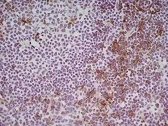 Anti-CD8 alpha antibody [KT15] used in IHC (Frozen sections) (IHC-Fr). GTX76350