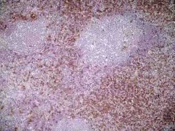 Anti-CD8 alpha antibody [KT15] used in IHC (Frozen sections) (IHC-Fr). GTX76350