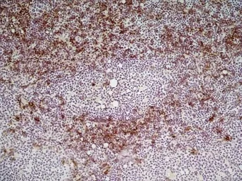 Anti-CD8 alpha antibody [KT15] used in IHC (Frozen sections) (IHC-Fr). GTX76350