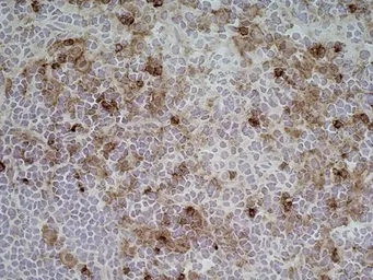 Anti-CD11b antibody [ED7] used in IHC (Frozen sections) (IHC-Fr). GTX76357