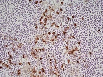 Anti-CD11b antibody [M1/70.15] used in IHC (Frozen sections) (IHC-Fr). GTX76473