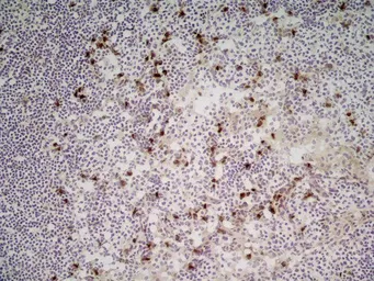Anti-CD11b antibody [M1/70.15] used in IHC (Frozen sections) (IHC-Fr). GTX76473